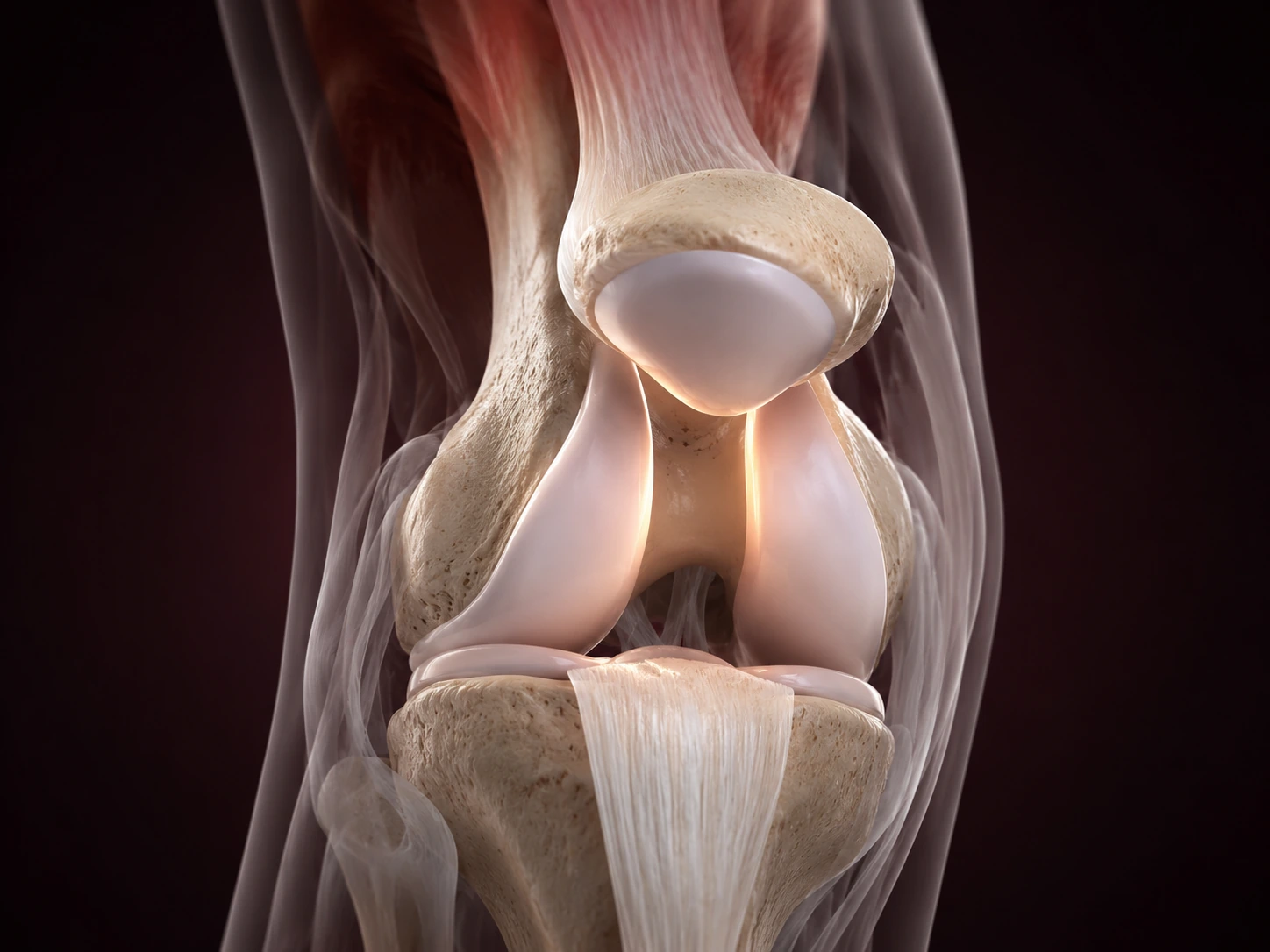 3D educational anatomy of the patellofemoral joint showing the kneecap, trochlear groove and cartilage surfaces