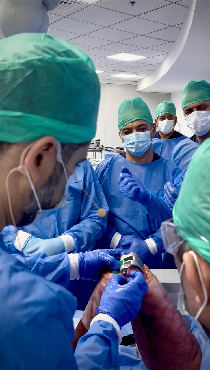 Real operating theatre photograph of knee replacement surgery supplied by Prof. Dr. Sammy Hanna