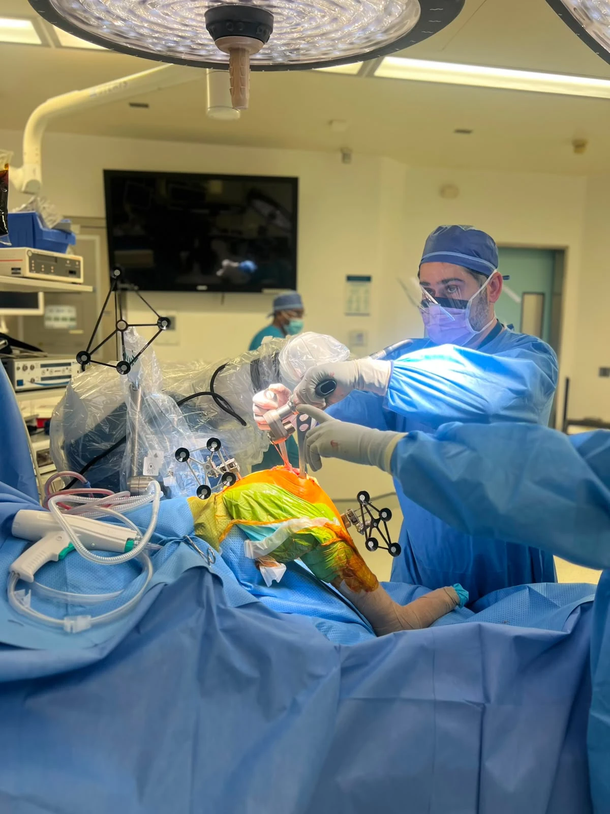 Prof. Dr. Sammy Hanna performing robotic-assisted knee replacement surgery in theatre